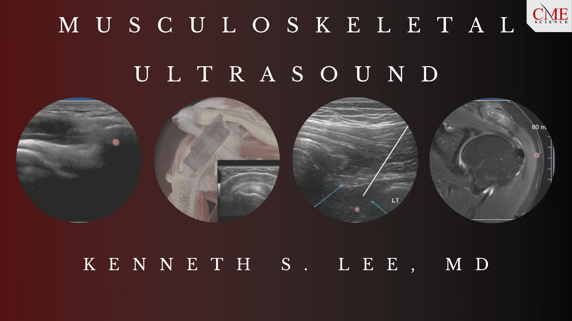 MSK Ultrasound Lee MD