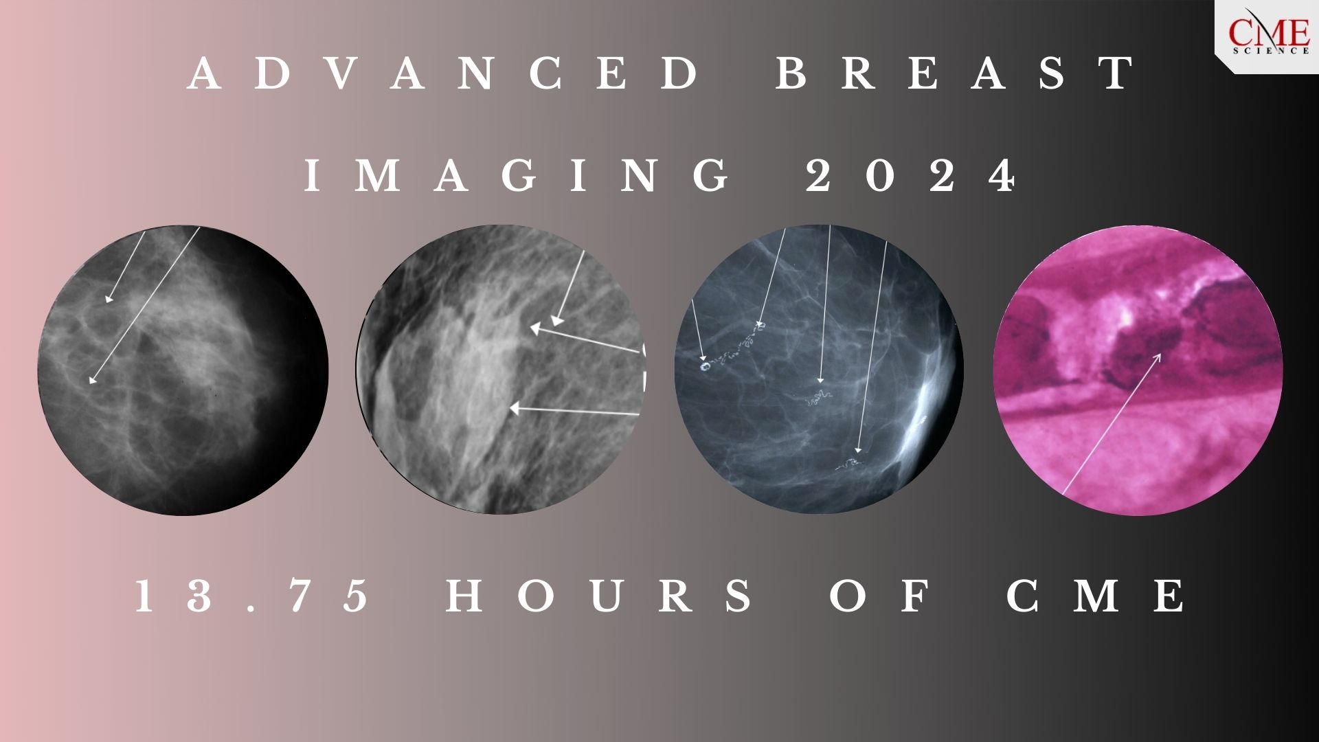 Advanced Breast Imaging 2024   Adv BI 2024 